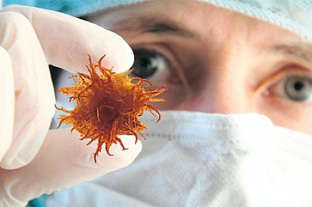 Xərçəngdən öləcəkdi: qeyri-adi müalicədən sonra