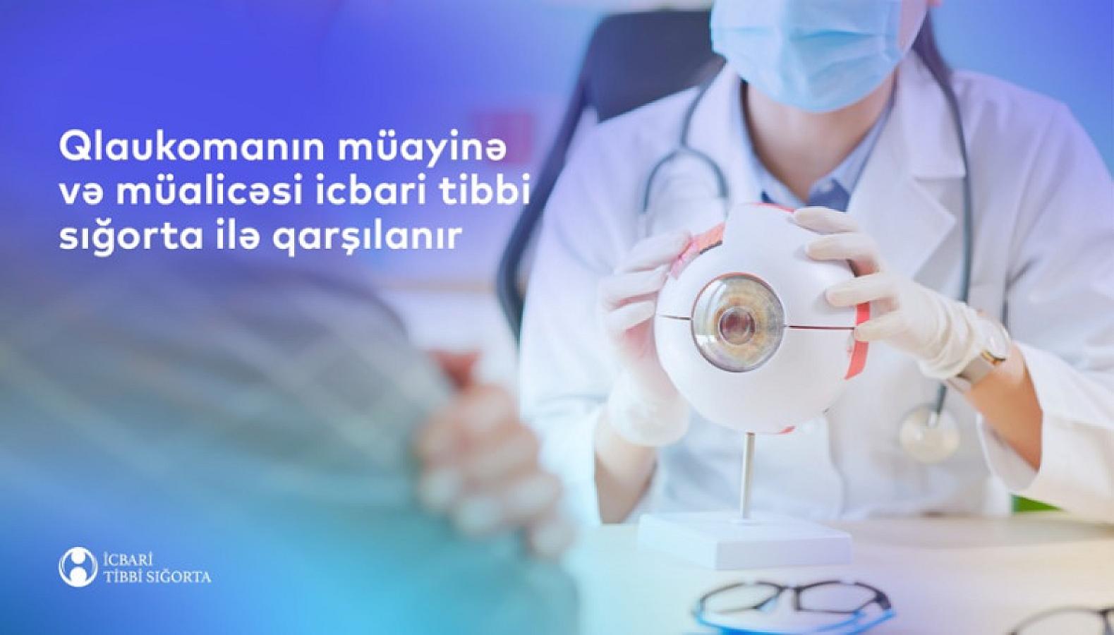 Qlaukomanın müayinə və müalicəsi icbari tibbi sığorta ilə