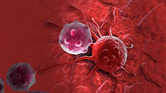 Alimlər döş xərçənginin inkişafını izləmək üçün yeni üsul tapıblar