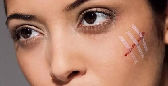 Yaranı necə tez sağaltmaq olar?