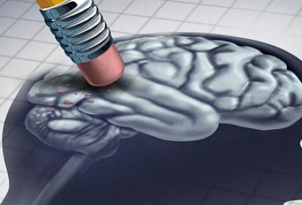 Alzheimer xəstəliyi orqan nəqli ilə də yayıla bilər