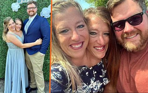 Bitişik əkizlər evləndi