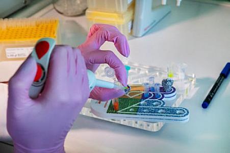 Xərçəng zamanı yaranan depressiyanın müalicəsində