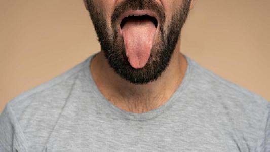 Sağlam insanın dili belə görünür