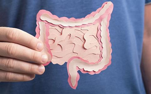 Alimlər: Diş əti xəstəliyi yüksək bağırsaq xərçəngi riski ilə