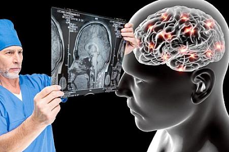 Nevroloqlar beyninizi cavan saxlamağın altı yolunu
