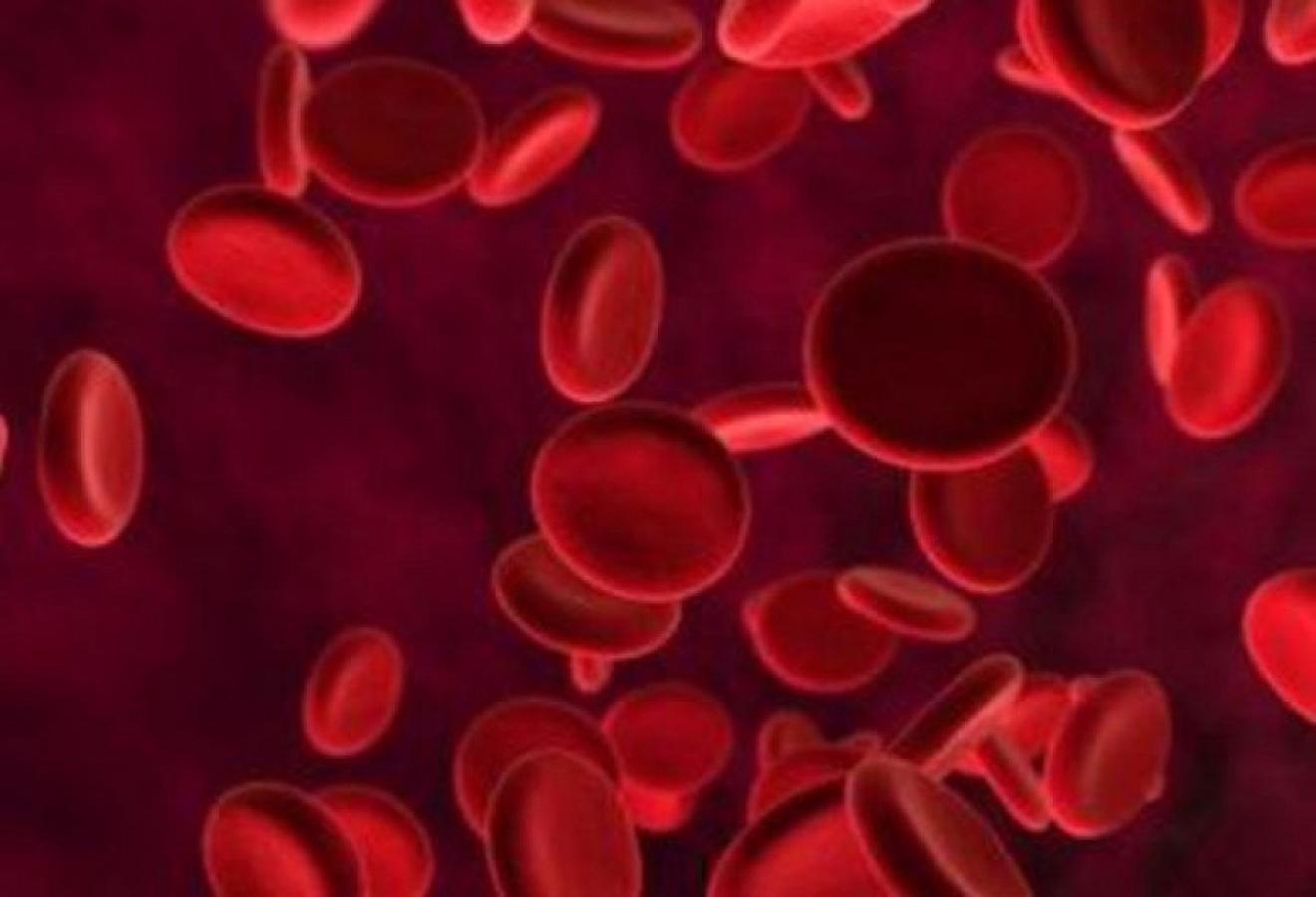 Hemofiliya xəstəliyinin yaranma səbəbləri və dərəcələri hansılardır?