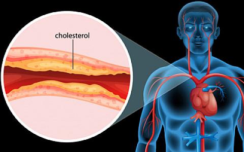 Damarları təmizləyən və təzyiqi salan çox sadə