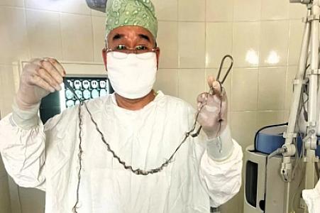 8 yaşlı qızın beynindən