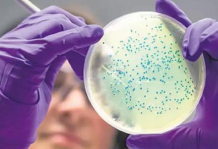 Bəzi ölümcül bakteriyalar “vampirlər kimi” insan qanı ilə qidalanır