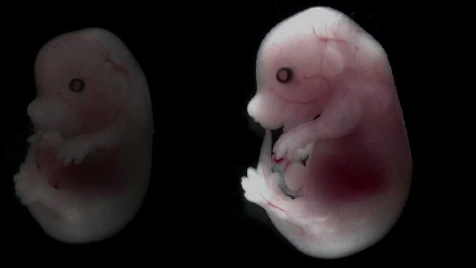 Süni spermatozoidlər yaradılacaq
