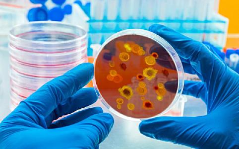 Süni intellekt yeni təhlükəli viruslar aşkarlayıb