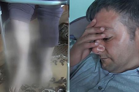 Fiziki məhdudiyyətli şəxsə əlillik təyin edilmir: