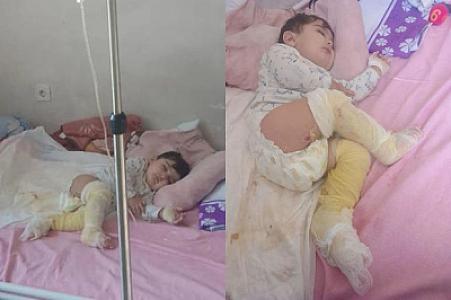 Körpə Muradın atası: “Yaralarını bağlamağa