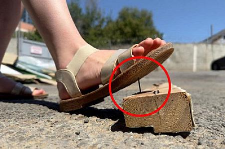 Ayağına mismar batan rusiyalı məktəblidə