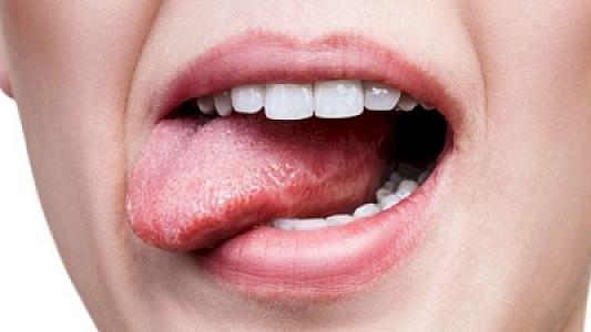 Dilinizdə bu rəng varsa, mütləq həkimə gedin