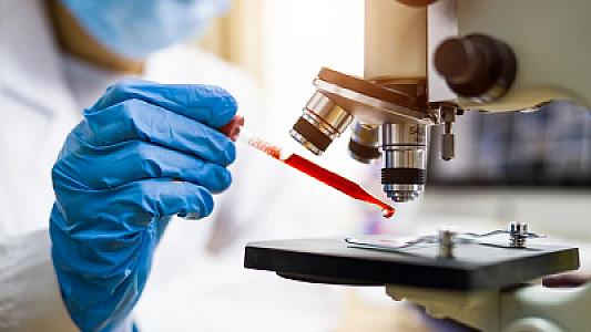 Elm adamları 7 il qabaqcadan xərçəng riskini aşkar etməyin