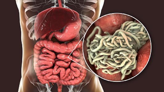 Qurdun təbii yolla müalicəsi