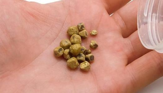 Çox ac qalmaq öddə daş əmələ gətirir