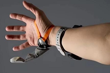 Alimlərdən yeni kəşf: Ələ əlavə edilən bir barmaq insanı