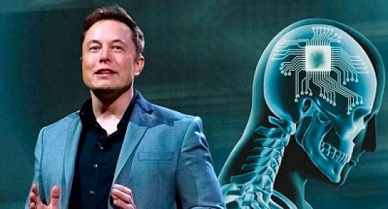 "Gələcəkdə telefonlar olmayacaq, yalnız beyin implantları olacaq"