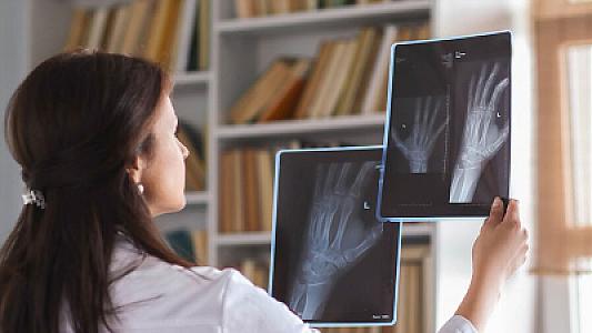 Alimlər smartfonlar üçün rentgen görmənin