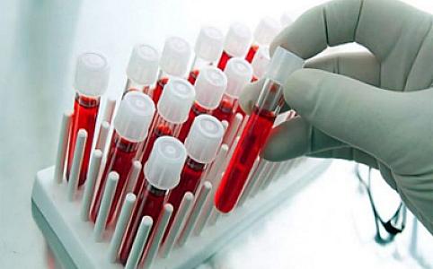 Komitə sədri: Hər il yüzlərlə nikaha girmək istəyənlər arasında təhlükəli xəsətliklər aşkarlanır