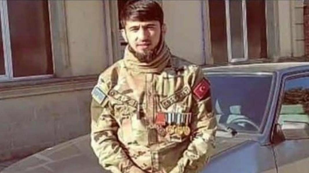 Özünü yandıran qazi dünyasını dəyişdi -