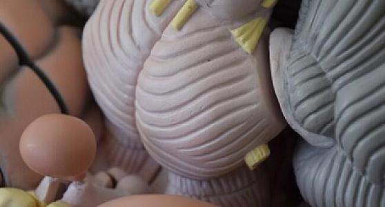 Beyin şişinə müqavimət göstərən