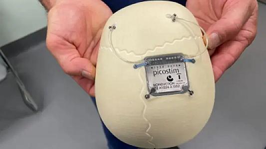 Tibb tarixində bir İLK: İngiltərə həkimləri