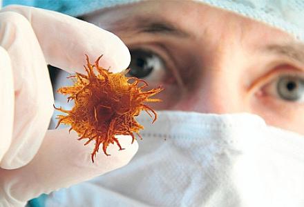 Xərçəngin ən aqressiv növünün müalicəsi