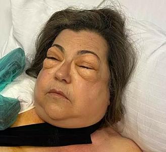 Dünyada cəmi 3 nəfərin başına gəlib: