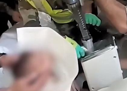 Azərbaycanda dəhşət - azyaşlının əli