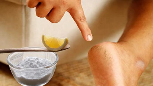 “Mazol”lardan necə qurtulmaq olar? -