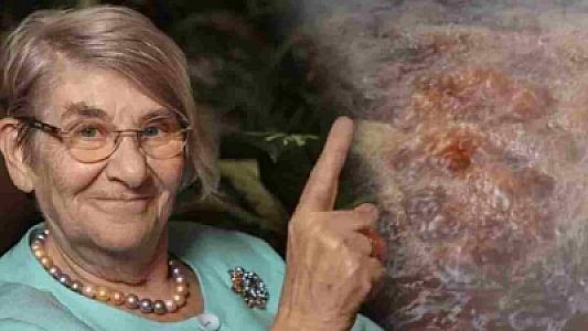 Canan Karataydan bədəni sıfırlayan qarışım: İmmunitet, dəri, yaddaş, sinir sistemi...