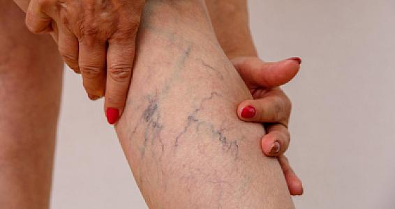 Bu qan qrupunda TROMBOZ riski daha