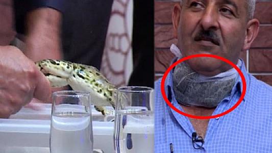 Zobu qurbağa ilə müalicə etmək