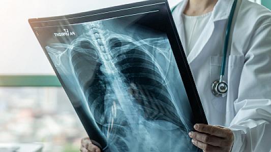 Fil suitilərinin qanı ağciyər xəstəlikləri ilə mübarizə aparmağa