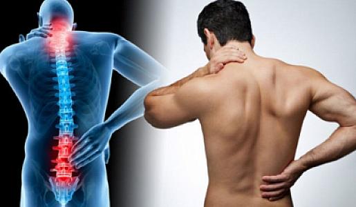 Disk yırtığı (qrija) problemi olanlar bu səhvləri etməməlidir -