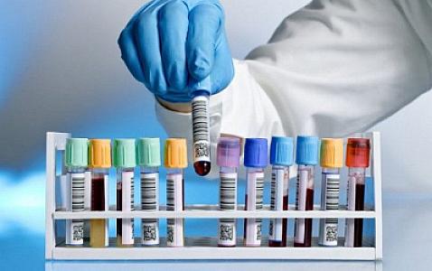 Hamilə qalmaq istəyən qadınlar bu testləri