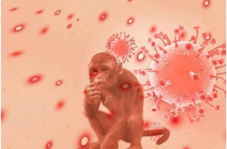 Meymun çiçəyi ilə Covid-19 arasındakı fərqlər nədir və