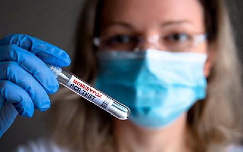 Azərbaycana meymunçiçəyi virusunun müayinəsi üçün testlər və xəstəliyə qarşı lazımi dərman preparatları gətirilib