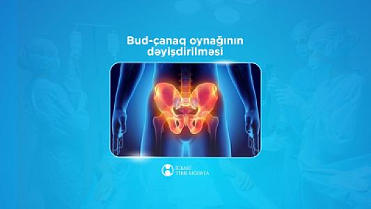 Bud-çanaq oynağının süni protezlə dəyişdirilməsi əməliyyatı ödənişsizdir?