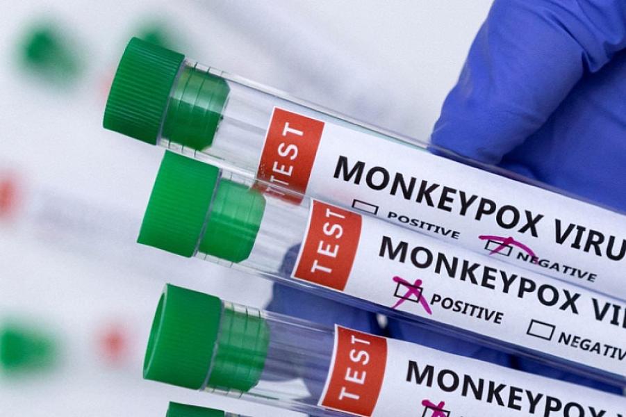 Azərbaycanda meymunçiçəyinin diaqnostikası və müalicəsi üçün