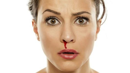 Sadə bir burun qanaması təhlükəli xəstəliklərin