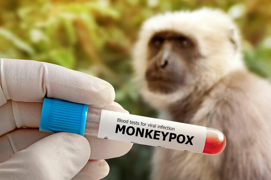 Meymunçiçəyi virusuna daha çox