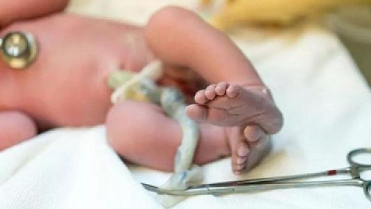 Göbək ciyəsi ilə autizm arasında əlaqə müəyyən edilib -