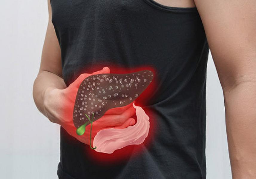 Qaraciyərin sağlamlığını qorumaq üçün