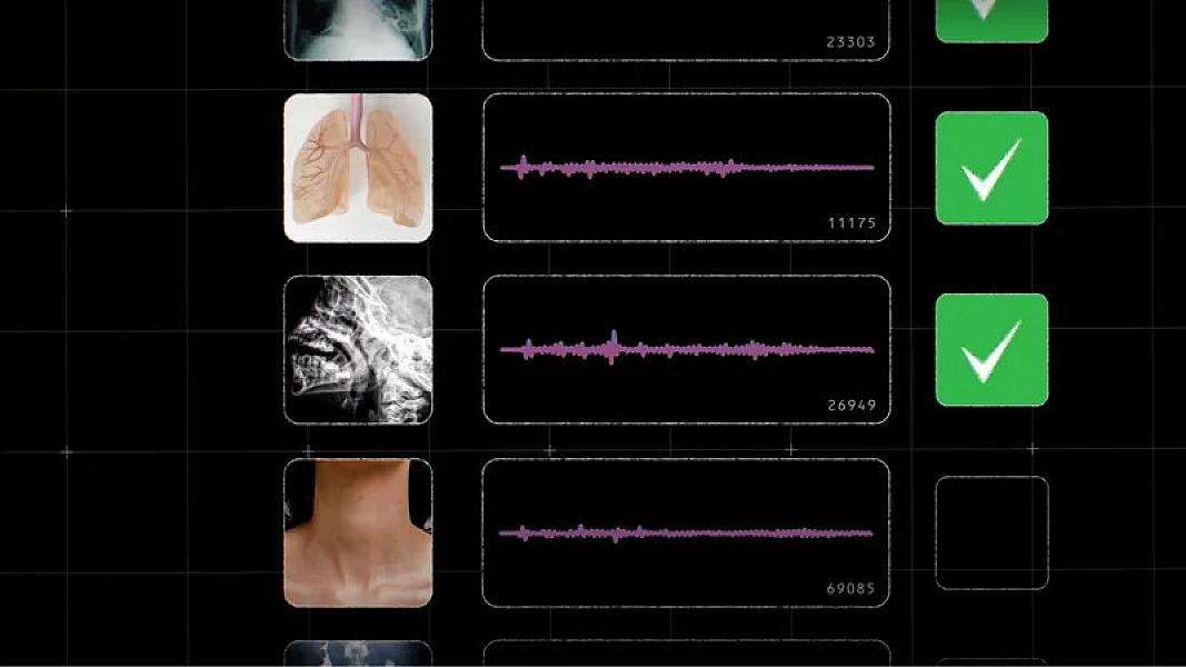 Süni intellekt modelinə öskürək səsi ilə