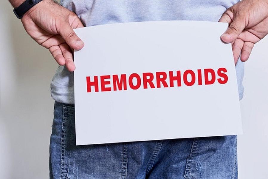 Deməyə utandığınız xəstəlik - Babasil (hemorroy) necə müalicə olunmalıdır?